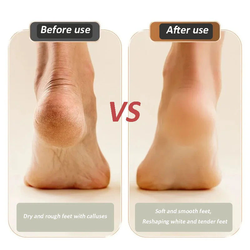š„Hot Saleš„USB rechargeable foot repair and grinding device